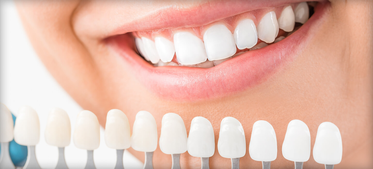 White Spots: What They Are and How To Get Rid Of Them - Center for  Restorative & Cosmetic Dentistry